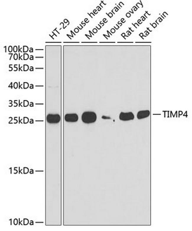 TIMP4 Antibody in Western Blot (WB)