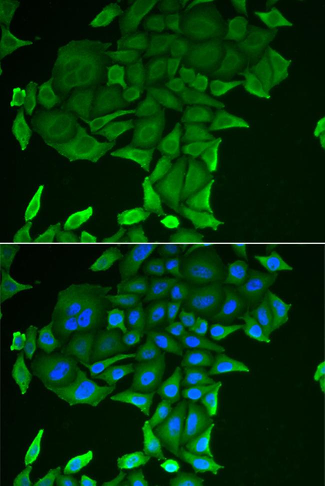 CD84 Antibody in Immunocytochemistry (ICC/IF)