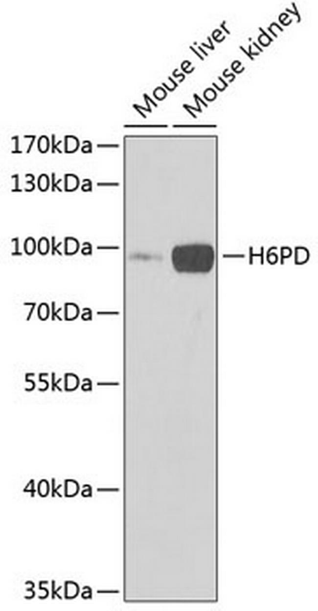 H6PD Antibody in Western Blot (WB)