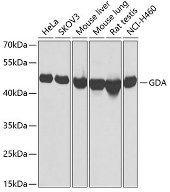 GDA Antibody in Western Blot (WB)