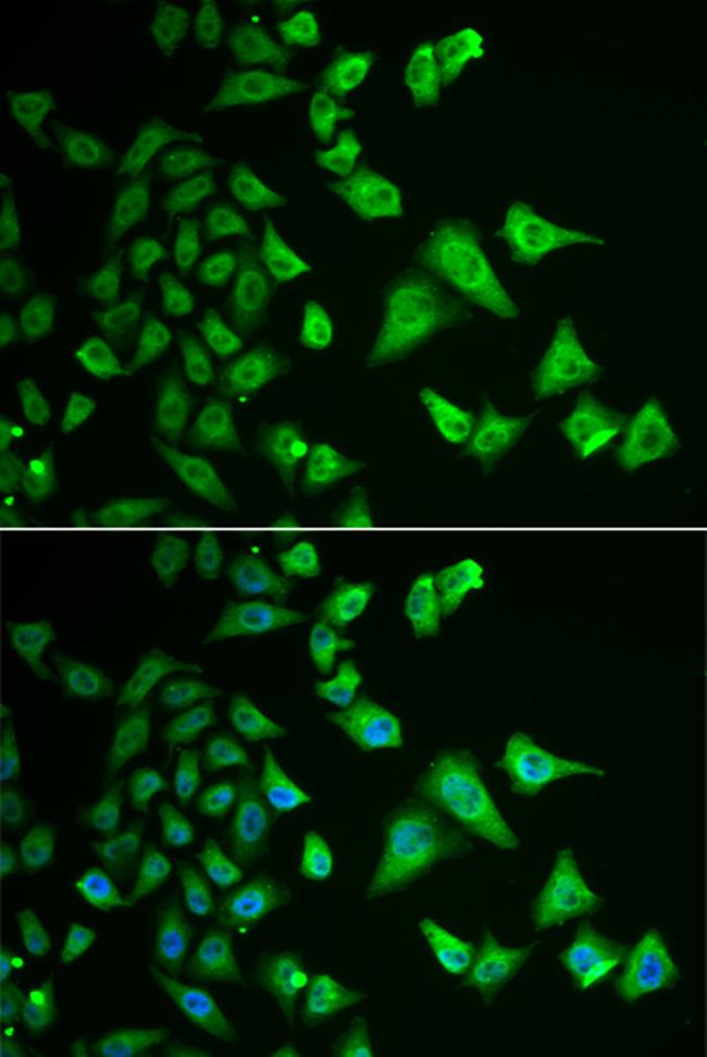 DHRS2 Antibody in Immunocytochemistry (ICC/IF)