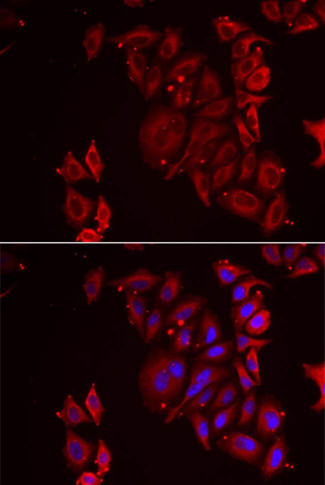 PAICS Antibody in Immunocytochemistry (ICC/IF)