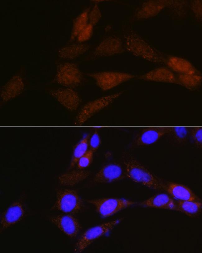 NRBF2 Antibody in Immunocytochemistry (ICC/IF)