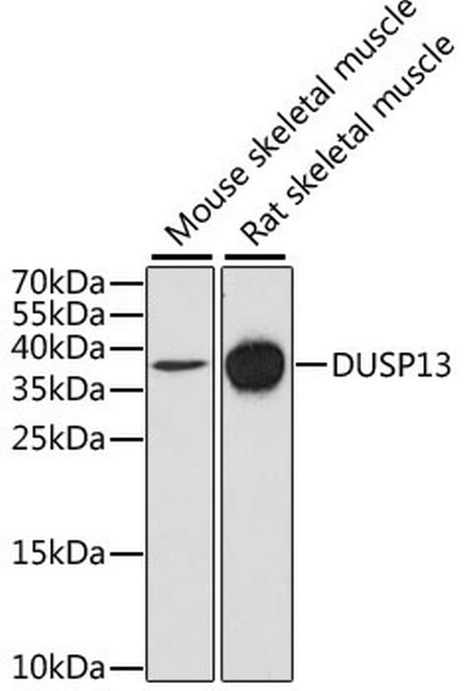 DUSP13 Antibody in Western Blot (WB)