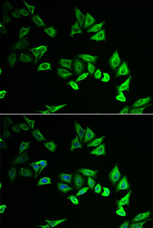 MYOZ2 Antibody in Immunocytochemistry (ICC/IF)