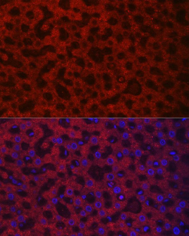 HAO1 Antibody in Immunocytochemistry (ICC/IF)