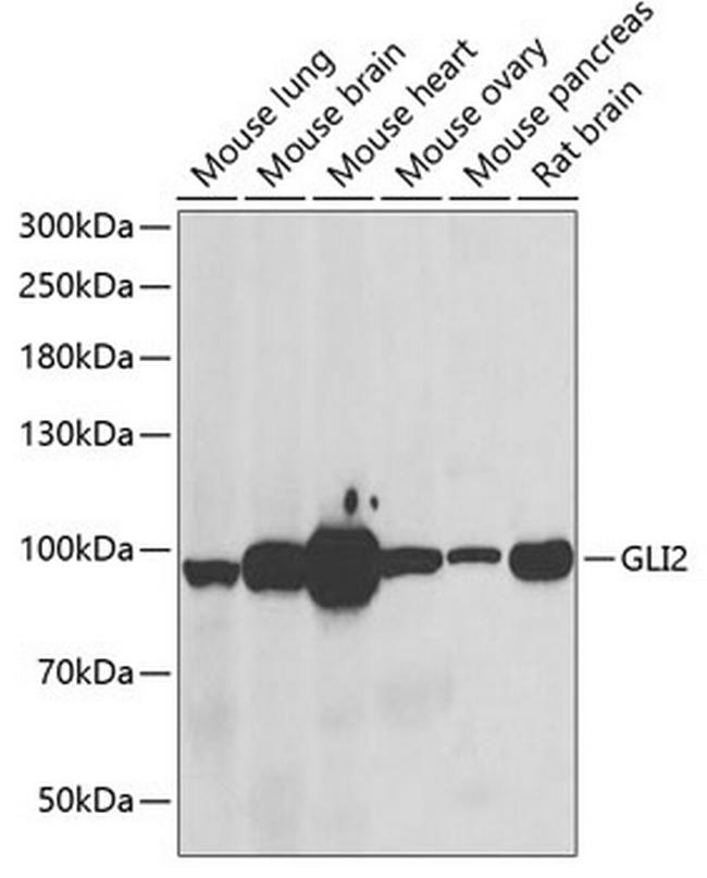 GLI2 Antibody in Western Blot (WB)