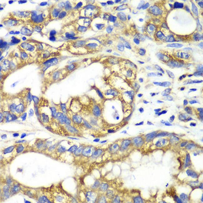 Adenylate Kinase 2 Antibody in Immunohistochemistry (Paraffin) (IHC (P))