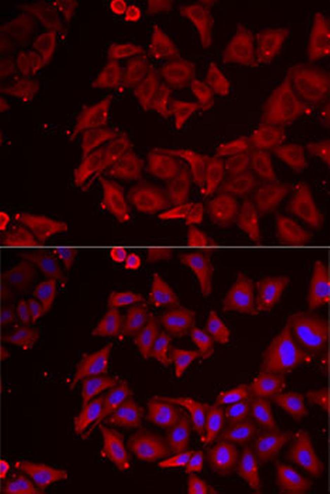 CMPK1 Antibody in Immunocytochemistry (ICC/IF)