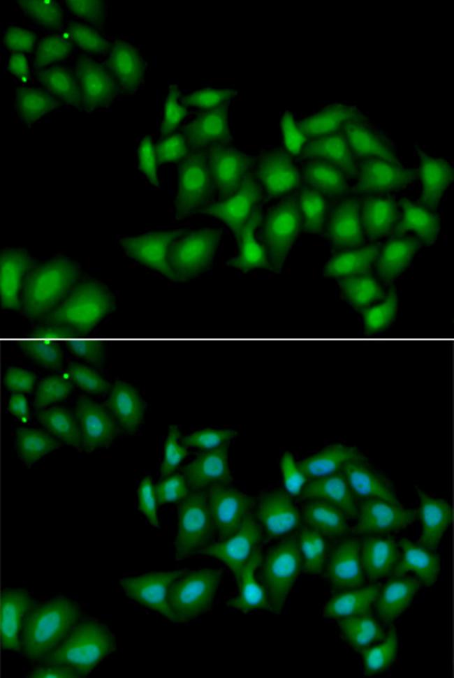 DDX1 Antibody in Immunocytochemistry (ICC/IF)