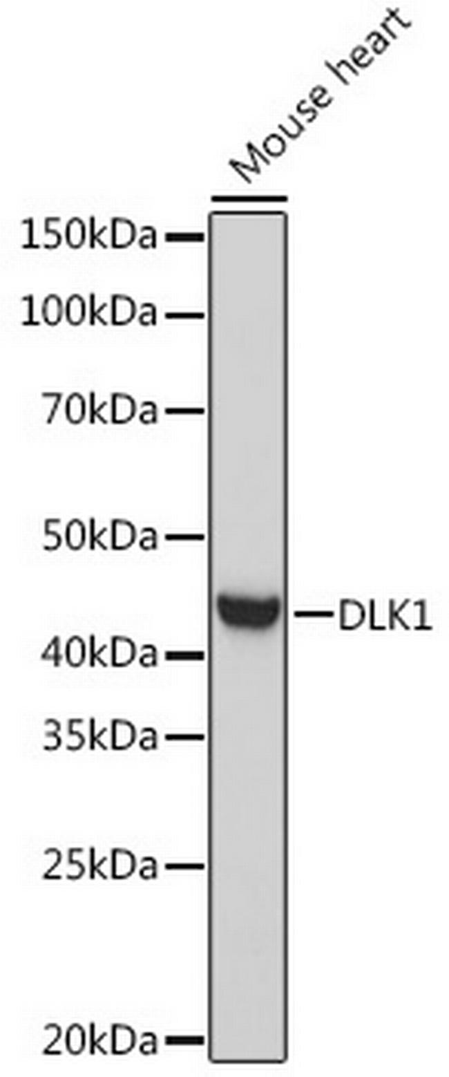 DLK1 Antibody in Western Blot (WB)