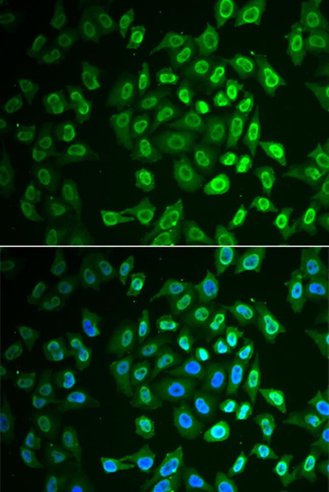 FAH Antibody in Immunocytochemistry (ICC/IF)