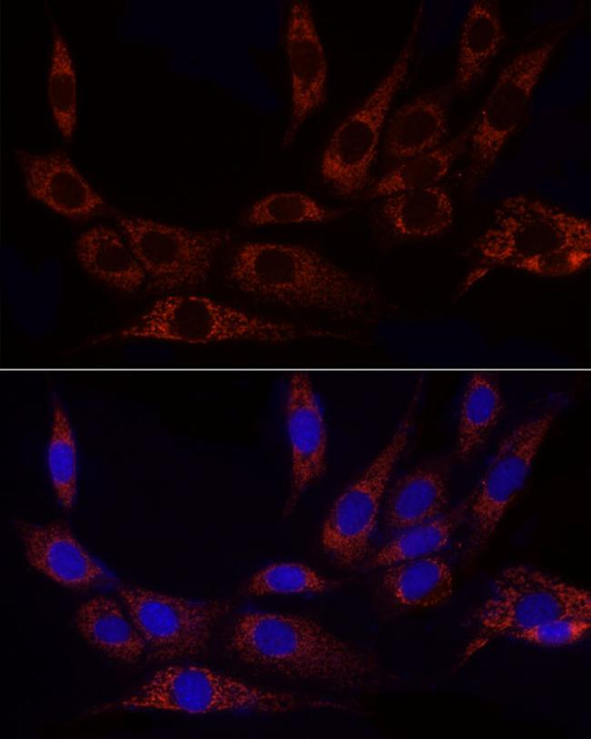 GluD2 Antibody in Immunocytochemistry (ICC/IF)