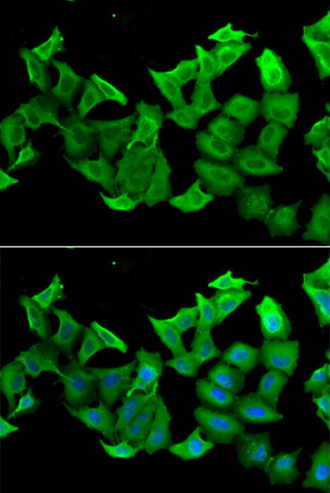 HAGH Antibody in Immunocytochemistry (ICC/IF)