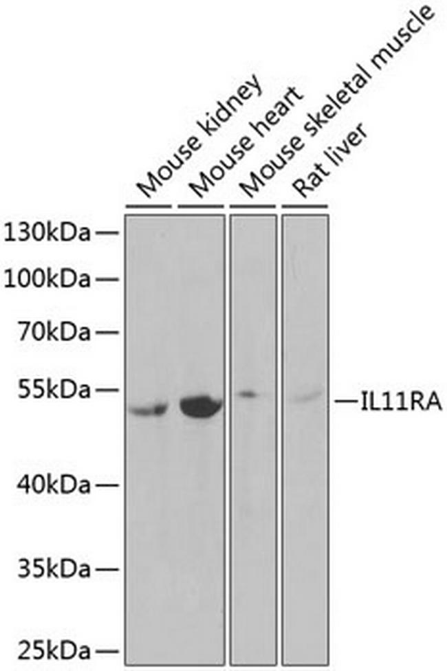 IL11RA Antibody in Western Blot (WB)