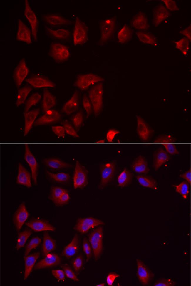 PDXK Antibody in Immunocytochemistry (ICC/IF)