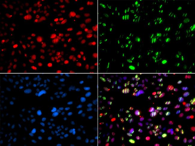 PNK Antibody in Immunocytochemistry (ICC/IF)