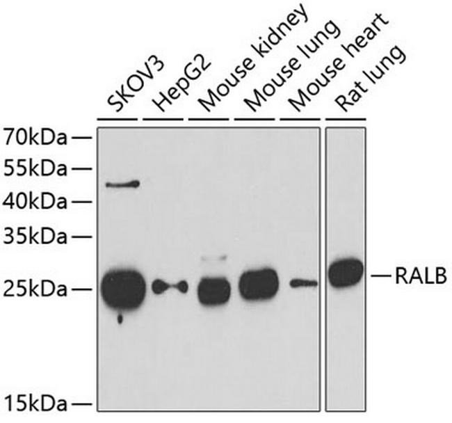 RALB Antibody in Western Blot (WB)