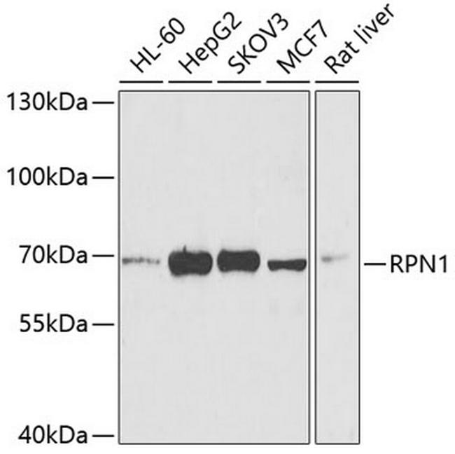 Ribophorin I Antibody in Western Blot (WB)