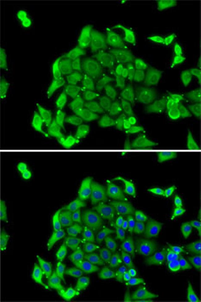 RPS14 Antibody in Immunocytochemistry (ICC/IF)