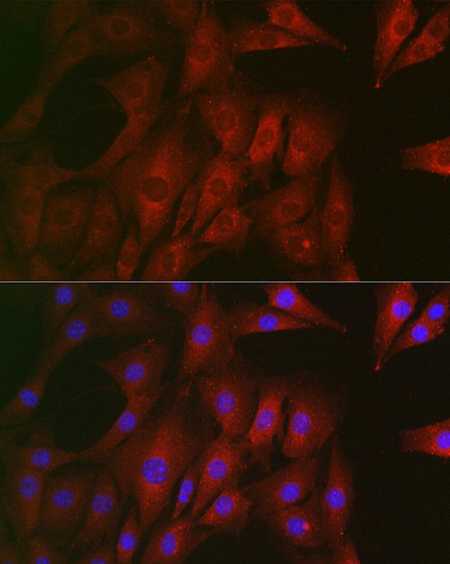 Rhotekin Antibody in Immunocytochemistry (ICC/IF)