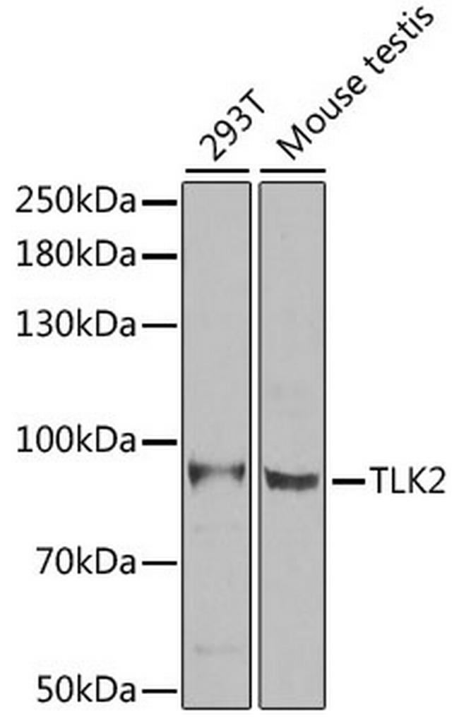 TLK2 Antibody in Western Blot (WB)