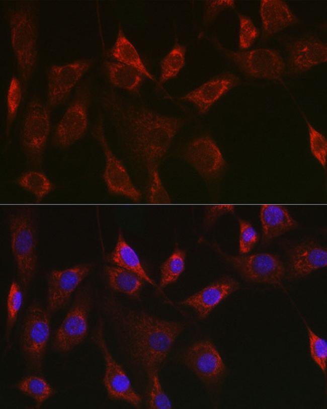 Thioredoxin 2 Antibody in Immunocytochemistry (ICC/IF)