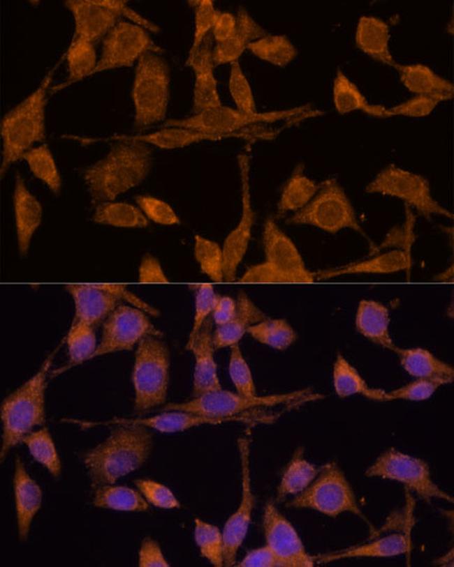 USP15 Antibody in Immunocytochemistry (ICC/IF)