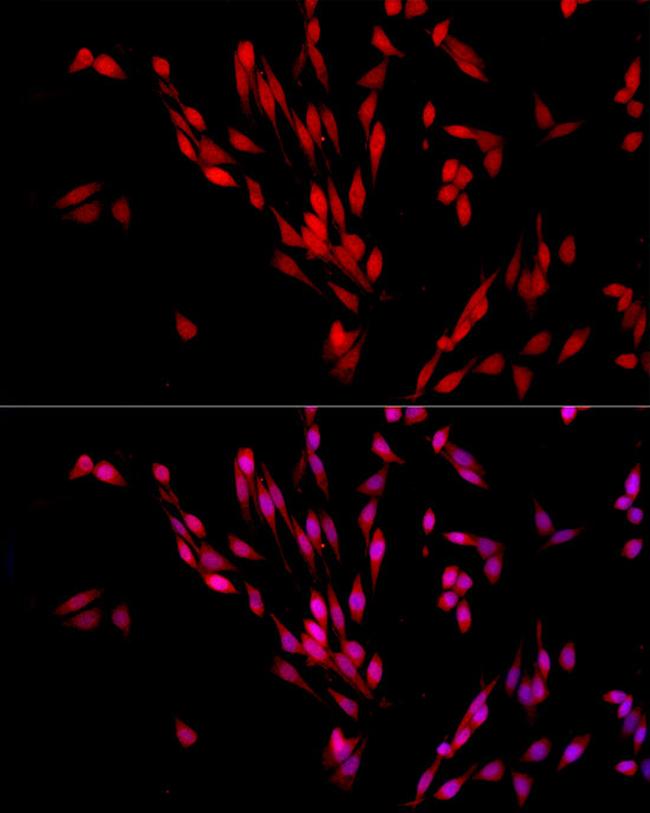 XPO5 Antibody in Immunocytochemistry (ICC/IF)