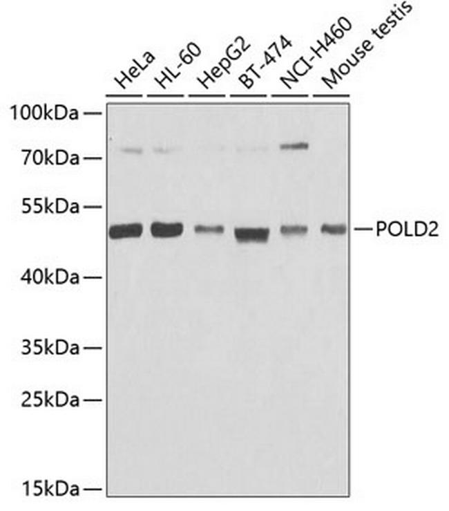 POLD2 Antibody in Western Blot (WB)