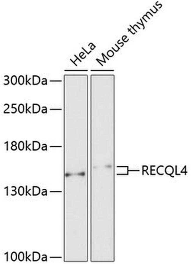 RECQ4 Antibody in Western Blot (WB)