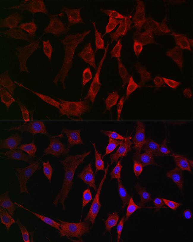 ALOX15B Antibody in Immunocytochemistry (ICC/IF)