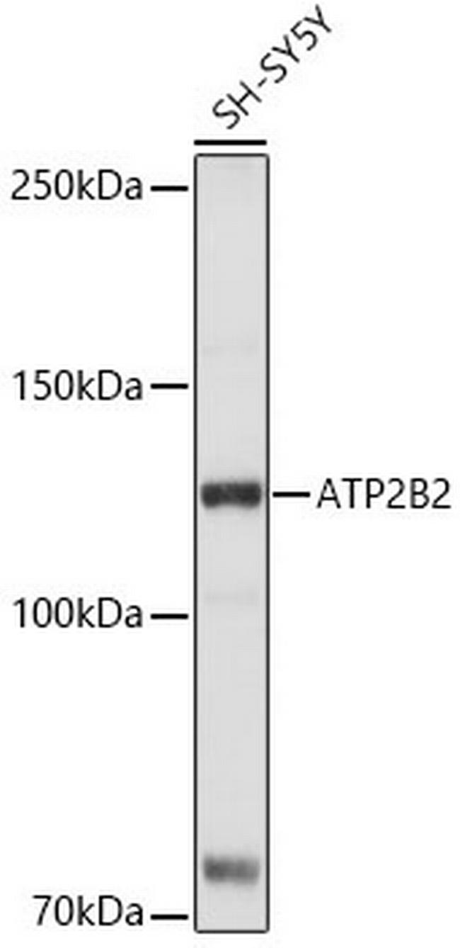 PMCA2 ATPase Antibody in Western Blot (WB)