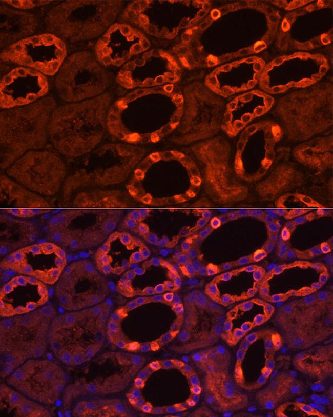 ATP6V1B1 Antibody in Immunohistochemistry (Paraffin) (IHC (P))