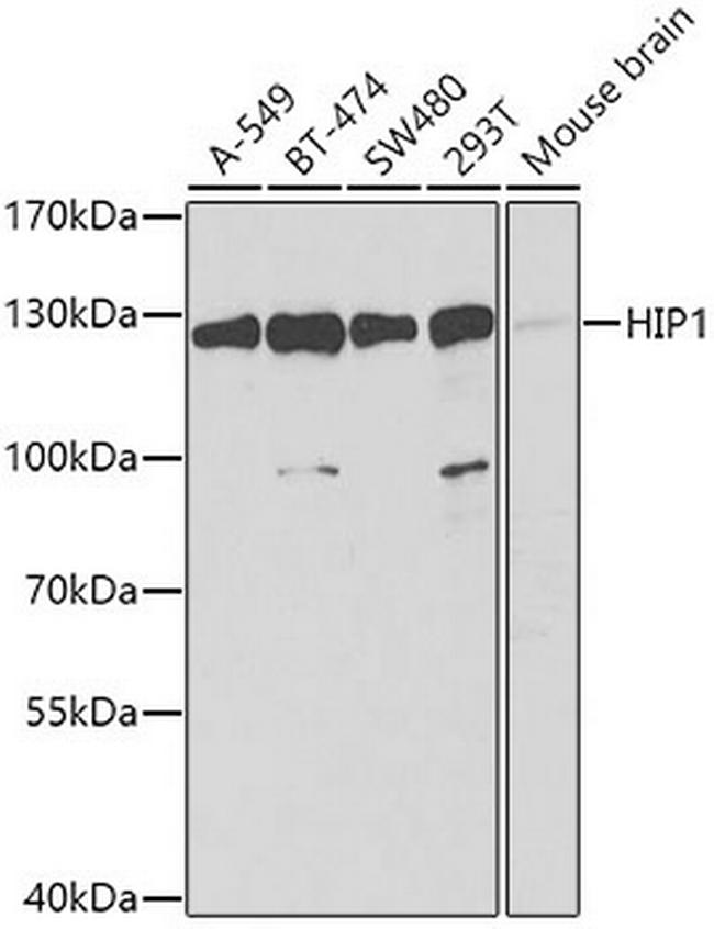 HIP1 Antibody in Western Blot (WB)