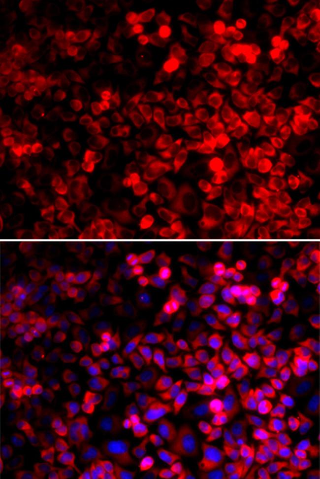 QARS Antibody in Immunocytochemistry (ICC/IF)