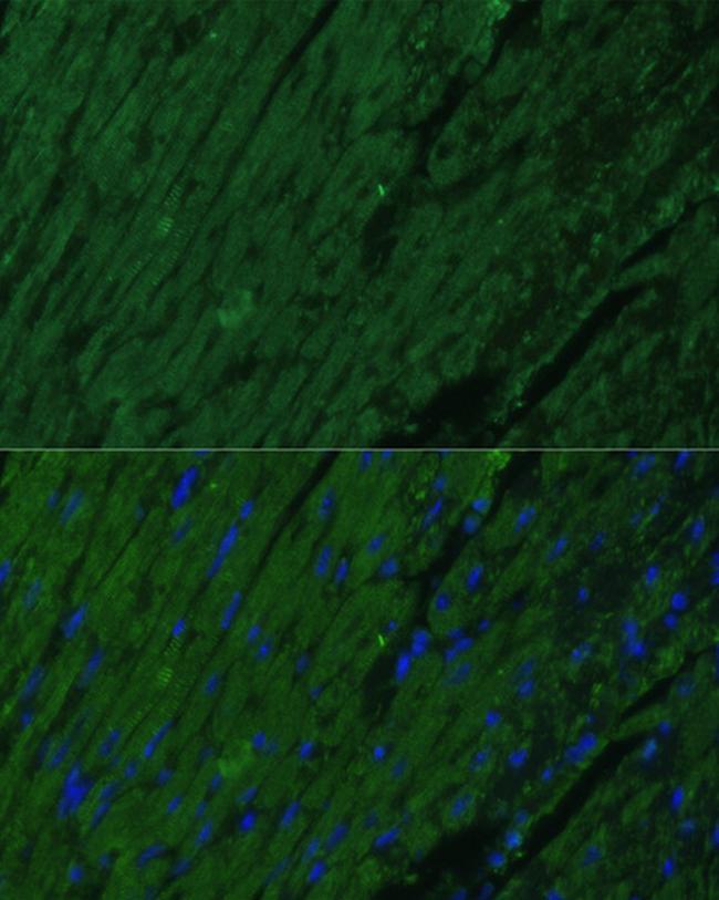 Cardiac Troponin I Antibody in Immunocytochemistry (ICC/IF)