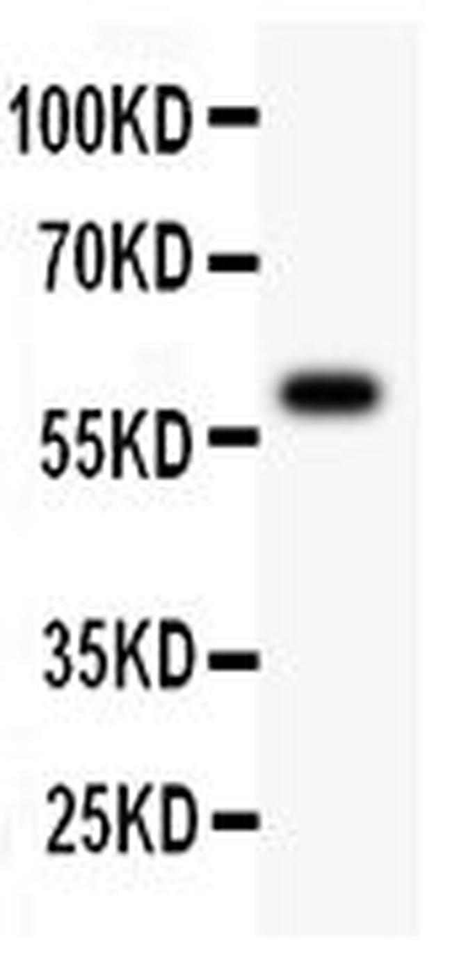 ATM Antibody in Western Blot (WB)