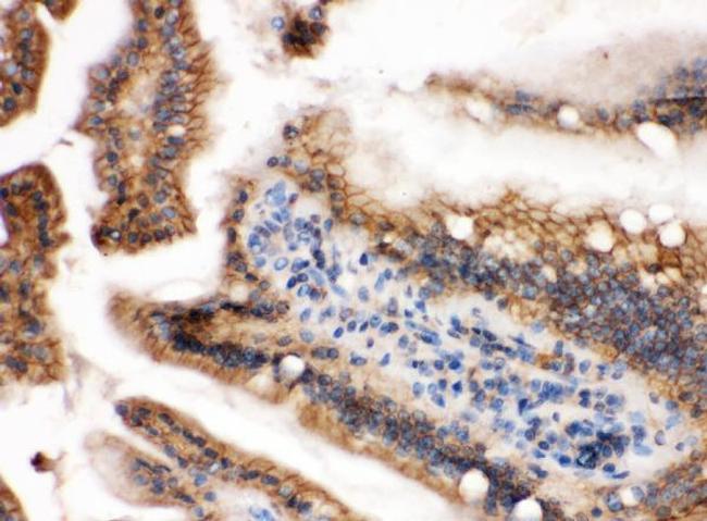 H-Ras Antibody in Immunohistochemistry (Paraffin) (IHC (P))