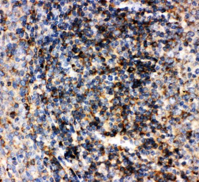 CD22 Antibody in Immunohistochemistry (Paraffin) (IHC (P))