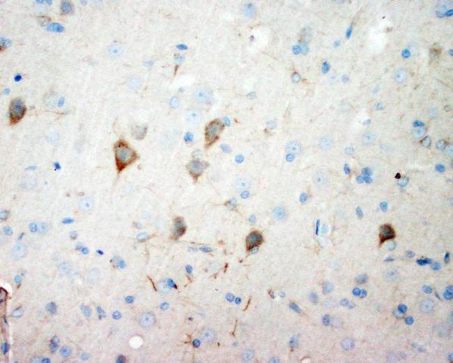 NSE Antibody in Immunohistochemistry (Paraffin) (IHC (P))