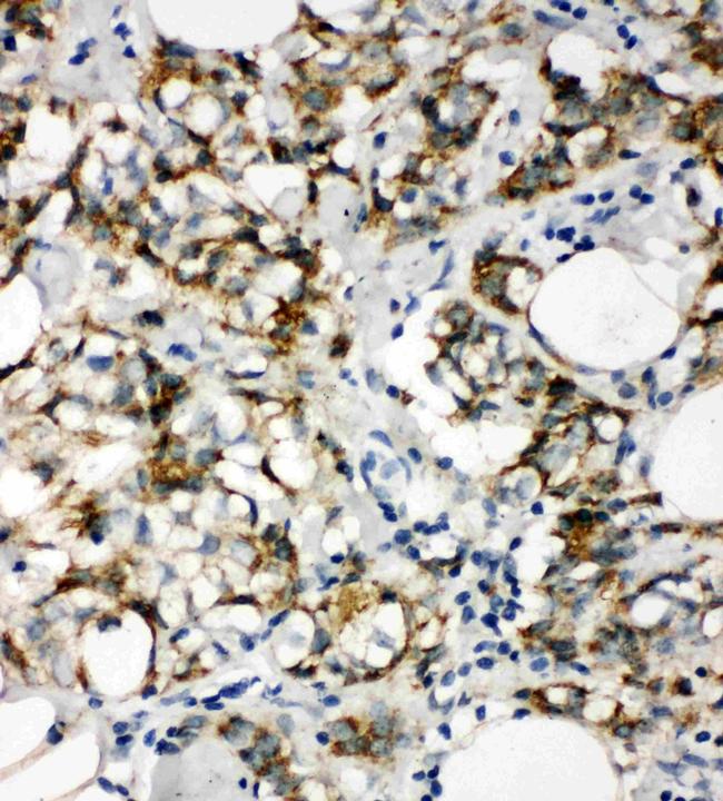 Cytokeratin 8 Antibody in Immunohistochemistry (Paraffin) (IHC (P))