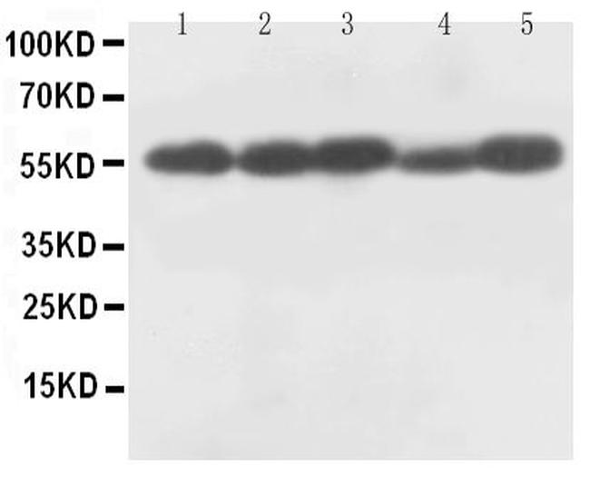 Caspase 8 p18 Antibody in Western Blot (WB)