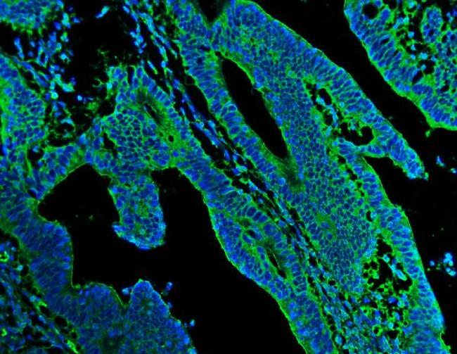 N-cadherin Antibody in Immunohistochemistry (Paraffin) (IHC (P))