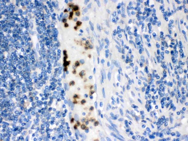 FABP3 Antibody in Immunohistochemistry (Paraffin) (IHC (P))