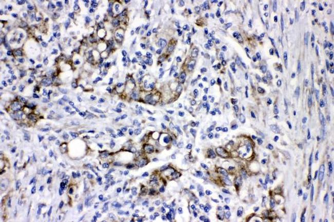 MEK3 Antibody in Immunohistochemistry (Paraffin) (IHC (P))