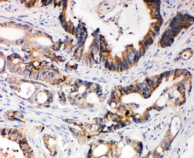 XIAP Antibody in Immunohistochemistry (Paraffin) (IHC (P))