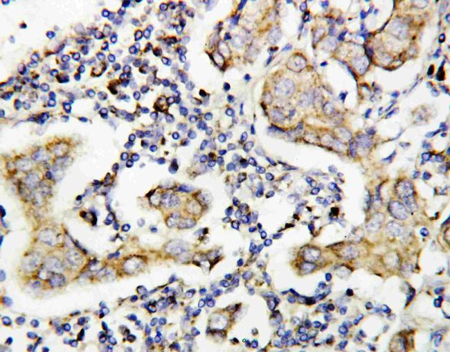 Caspase 8 p10 Antibody in Immunohistochemistry (Paraffin) (IHC (P))