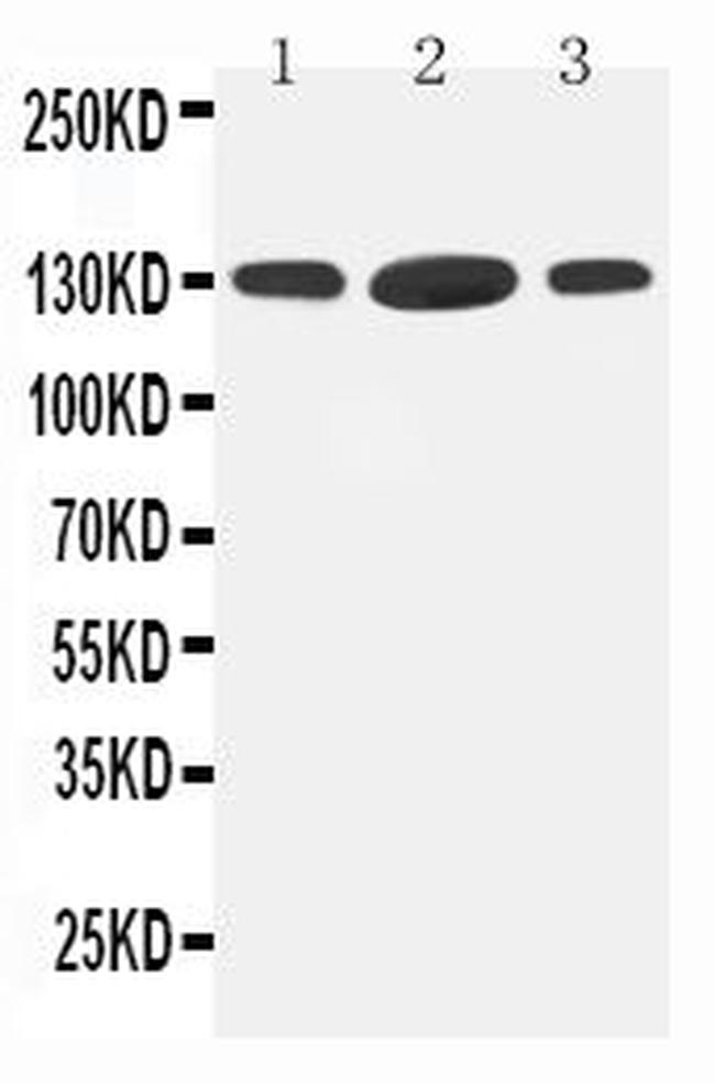 HDAC6 Antibody in Western Blot (WB)