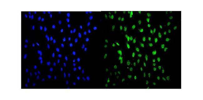 HSF2 Antibody in Immunocytochemistry (ICC/IF)